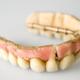 Full upper porcelain denture, London, England, 1795-1814